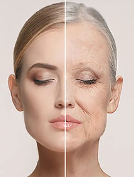 پروفایلو روشی برای بهبود کیفیت و آبرسانی عمیق پوست است، مخصوص افرادی که هنوز چین